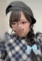 자수정 203 발 염좌 오빠 ♡