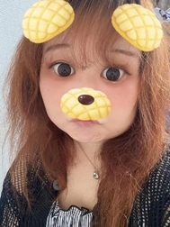 비지만 🥺