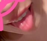 🩷 슈키 룬 🩷